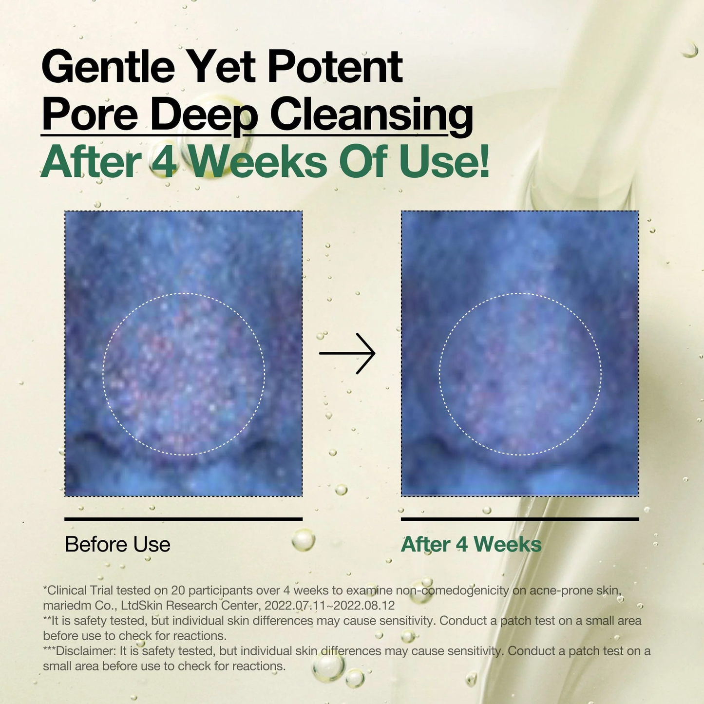 Heartleaf Pore Control Cleansing Oil Anua