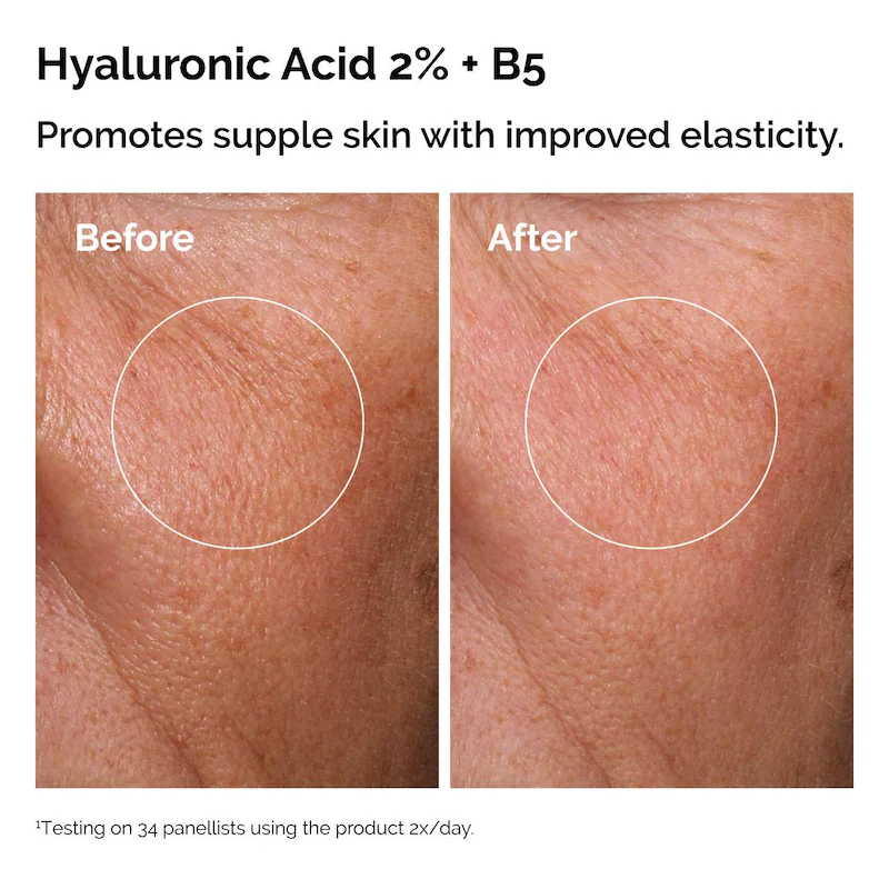 The skin support set with niacinamide + hyaluronic acid The Ordinary