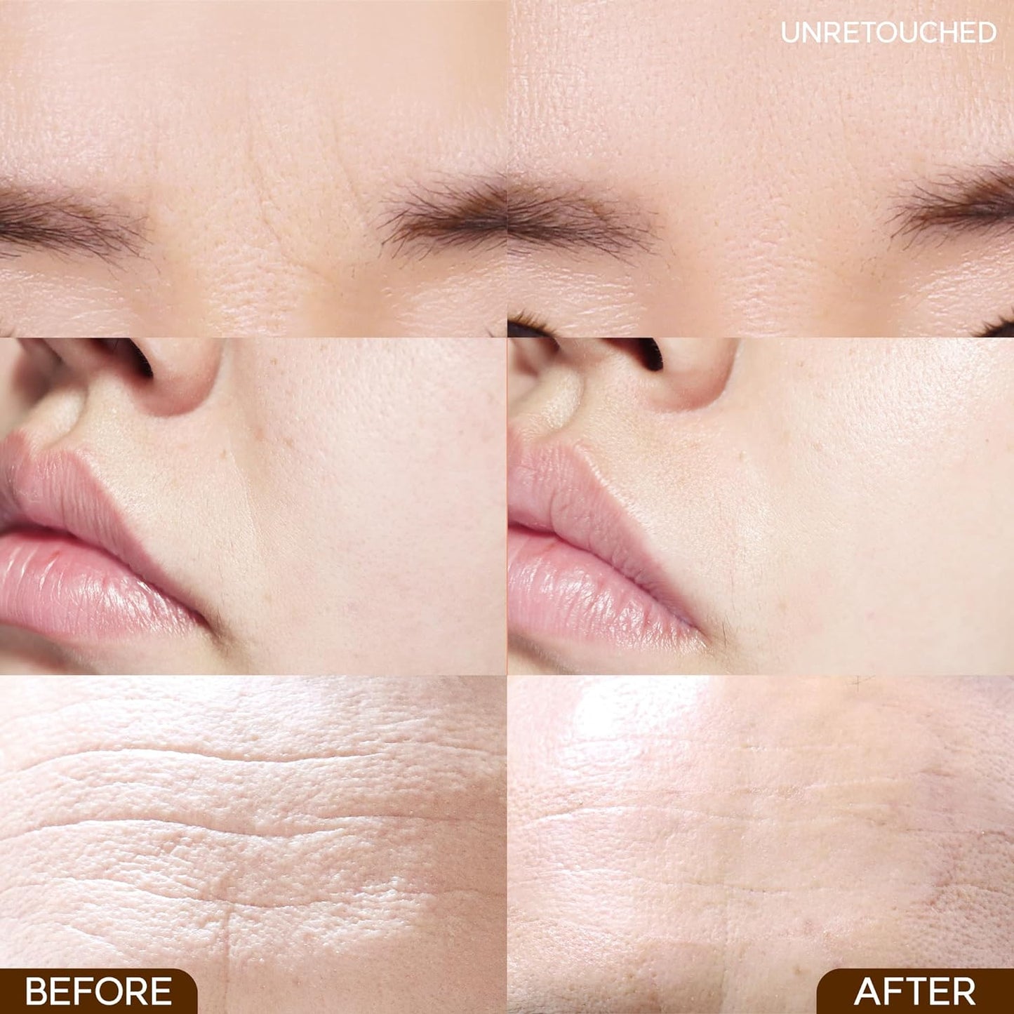 Wrinkle repair patch nasolabial folds Marshique