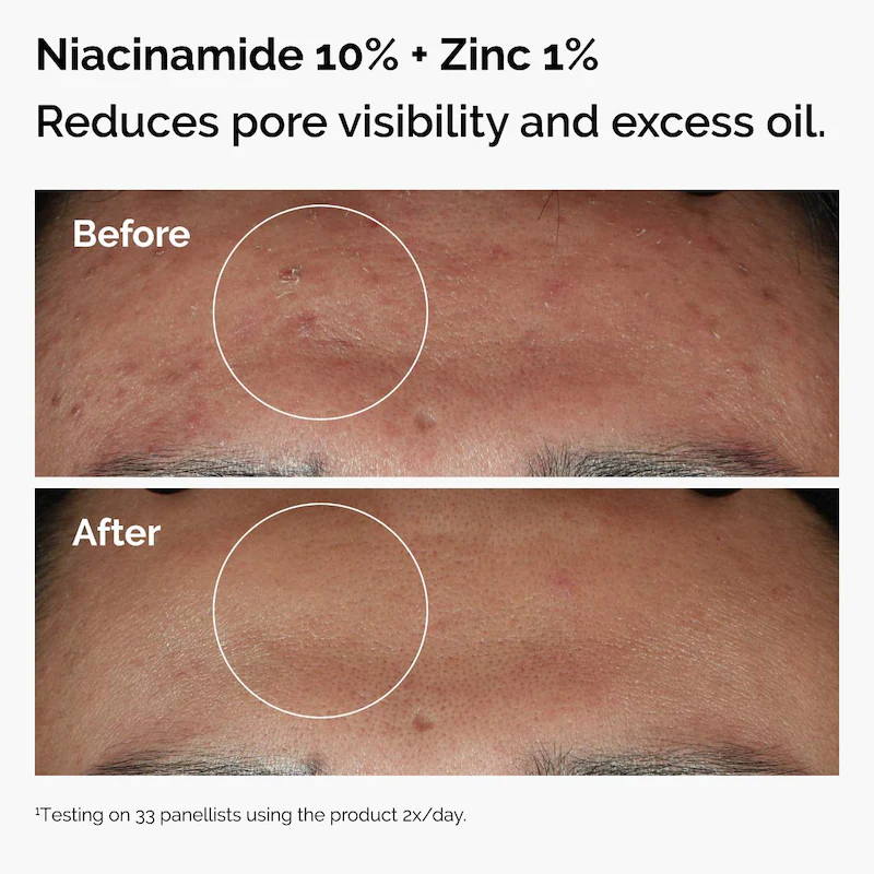 The skin support set with niacinamide + hyaluronic acid The Ordinary