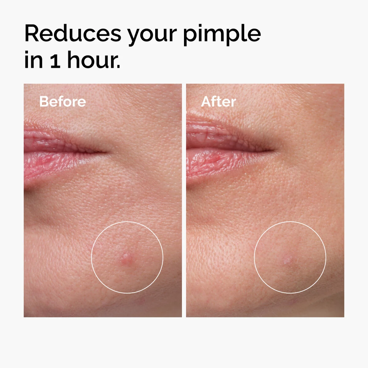 Sulfur 10% Powder-to-Cream Concentrate Acne Spot Treatment The Ordinary