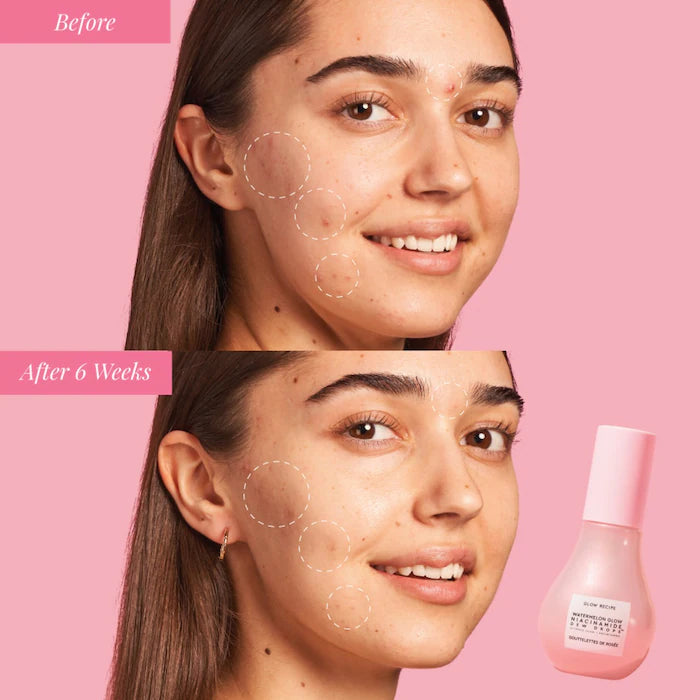 Watermelon glow niacinamide dew drops serum Glow Recipe