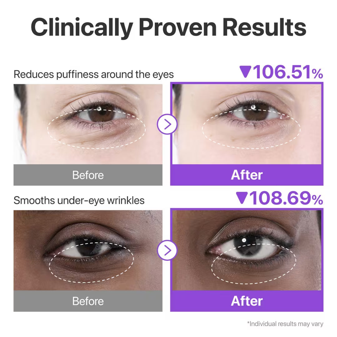No.9 NAD+ collagen cnder eye patch Numbuzin