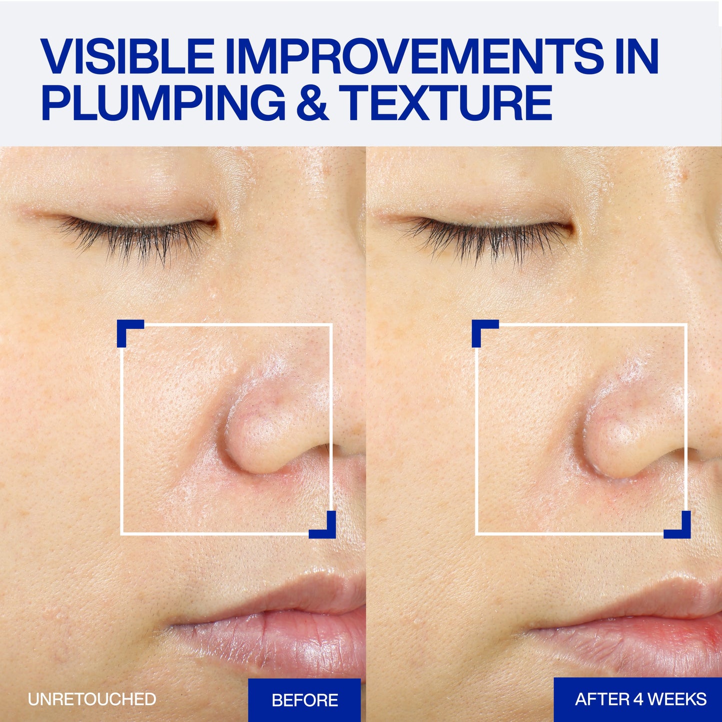 Stem lll clinical recovery serum IOPE