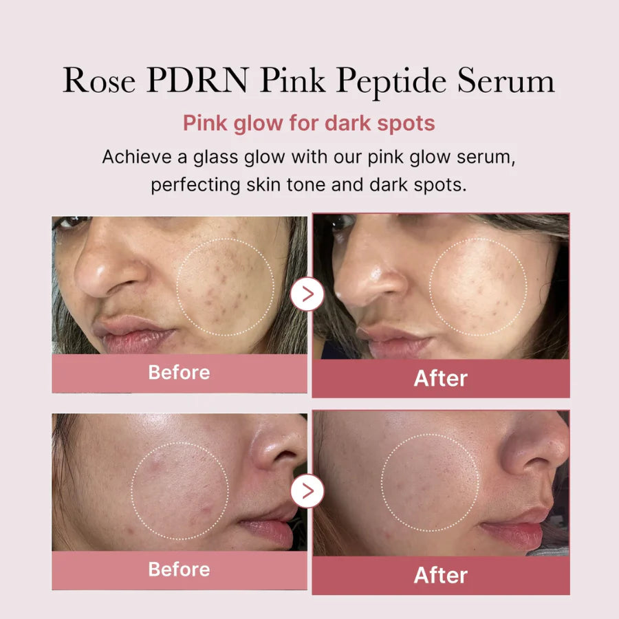 PDRN Pink Peptide Serum Medicube