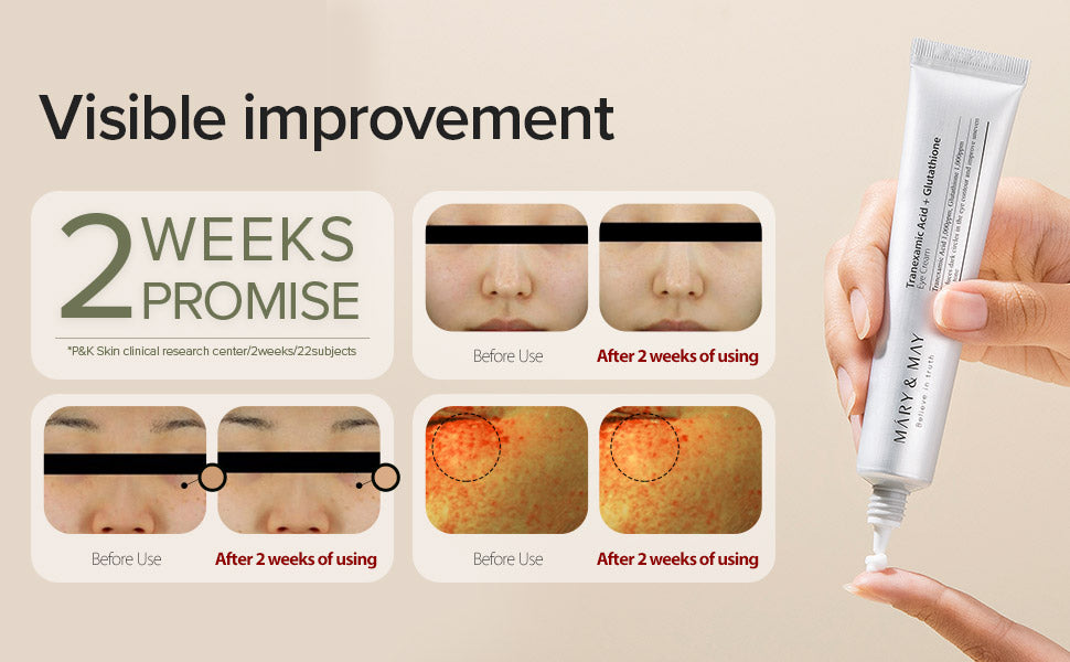 Tranexamic Acid+Glutathione Eye Cream Mary&May