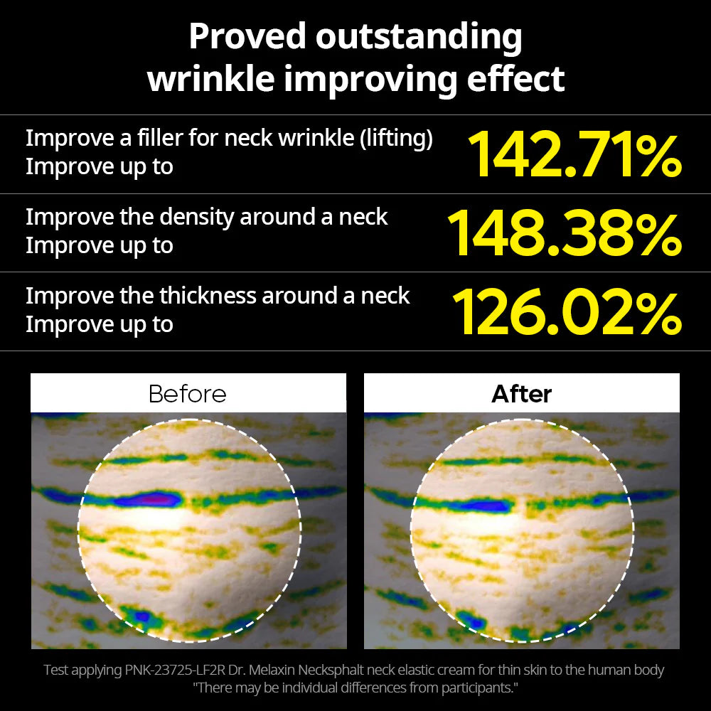 Necksphalt ECM Neck Barrier Cream Dr. Melaxin