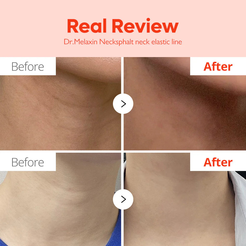 Necksphalt ECM Neck Barrier Cream Dr. Melaxin