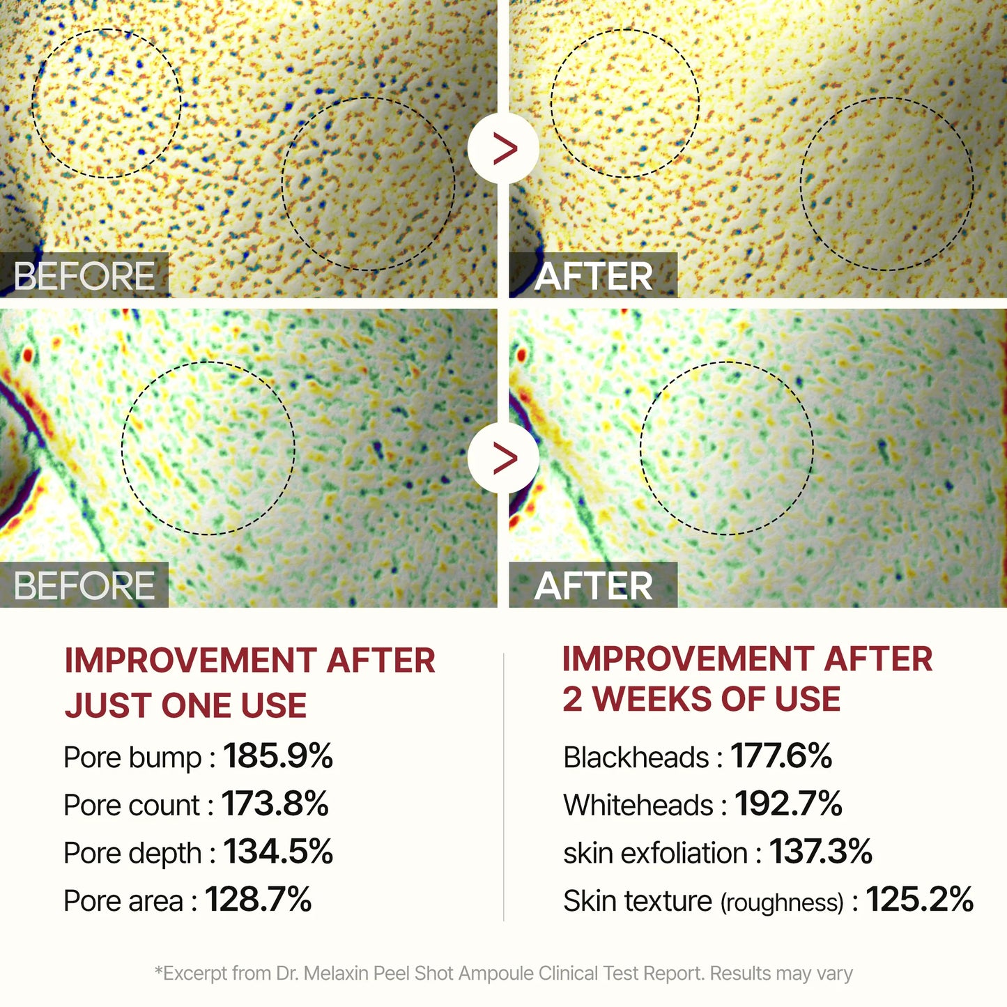 Peel Shot Glow White Rice Ampoule Dr. Melaxin