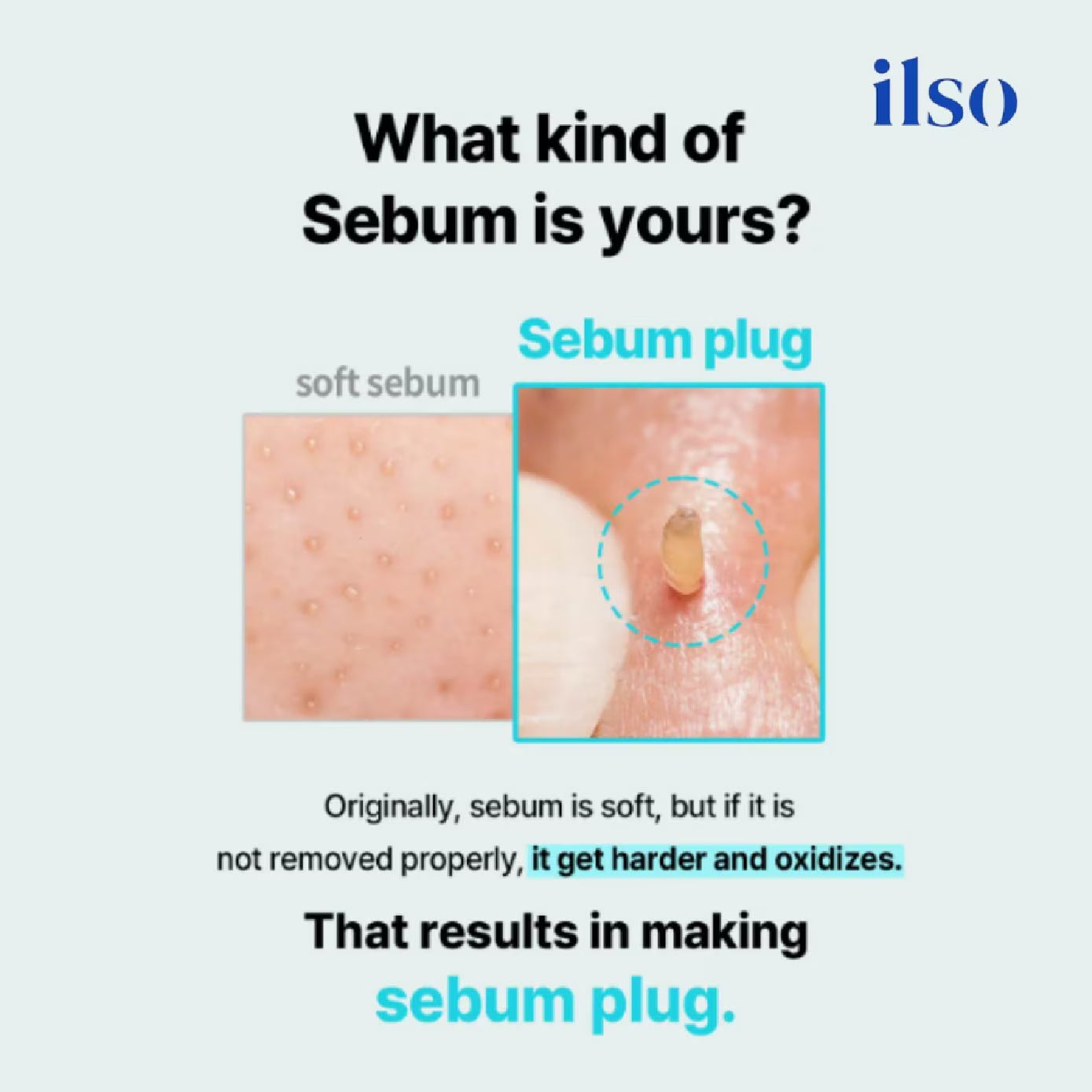 ilso Super Melting Sebum Softener 150ml Set +Cotton Pad 40P