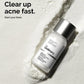 Sulfur 10% Powder-to-Cream Concentrate Acne Spot Treatment The Ordinary