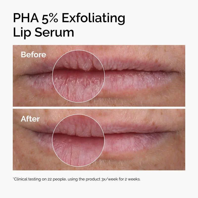 PHA 5% Exfoliating Lip Serum The Ordinary