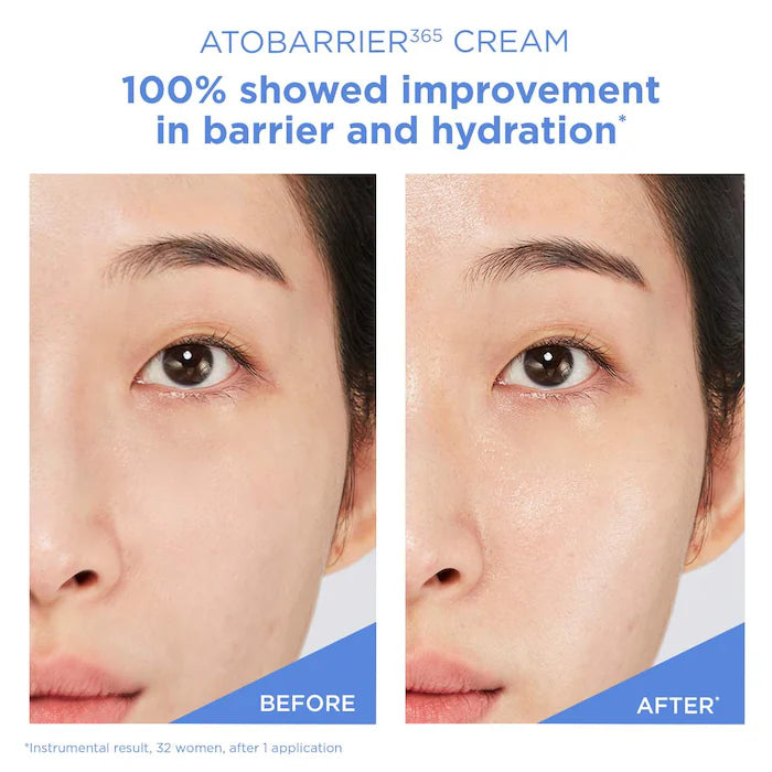 ATOBARRIER365 cream moisturizer with ceramides & niacinamide for skin moisture barrier repair AESTURA