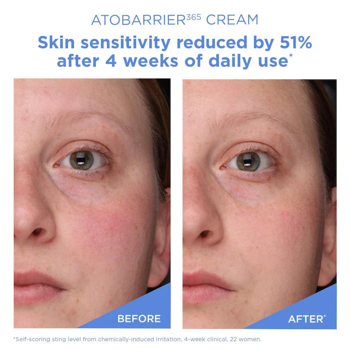 ATOBARRIER365 cream moisturizer with ceramides & niacinamide for skin moisture barrier repair AESTURA